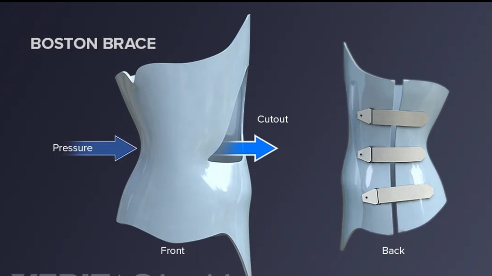 Spinal brace