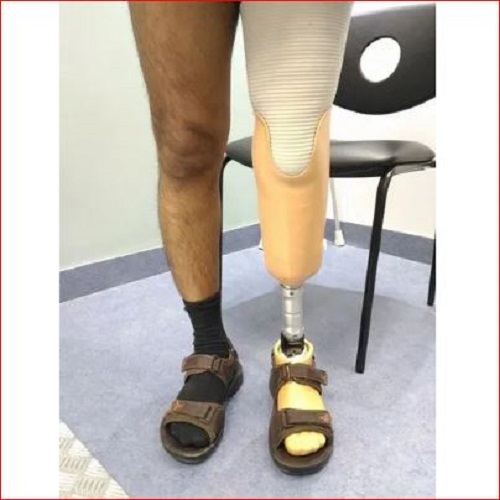 Below knee prosthesis